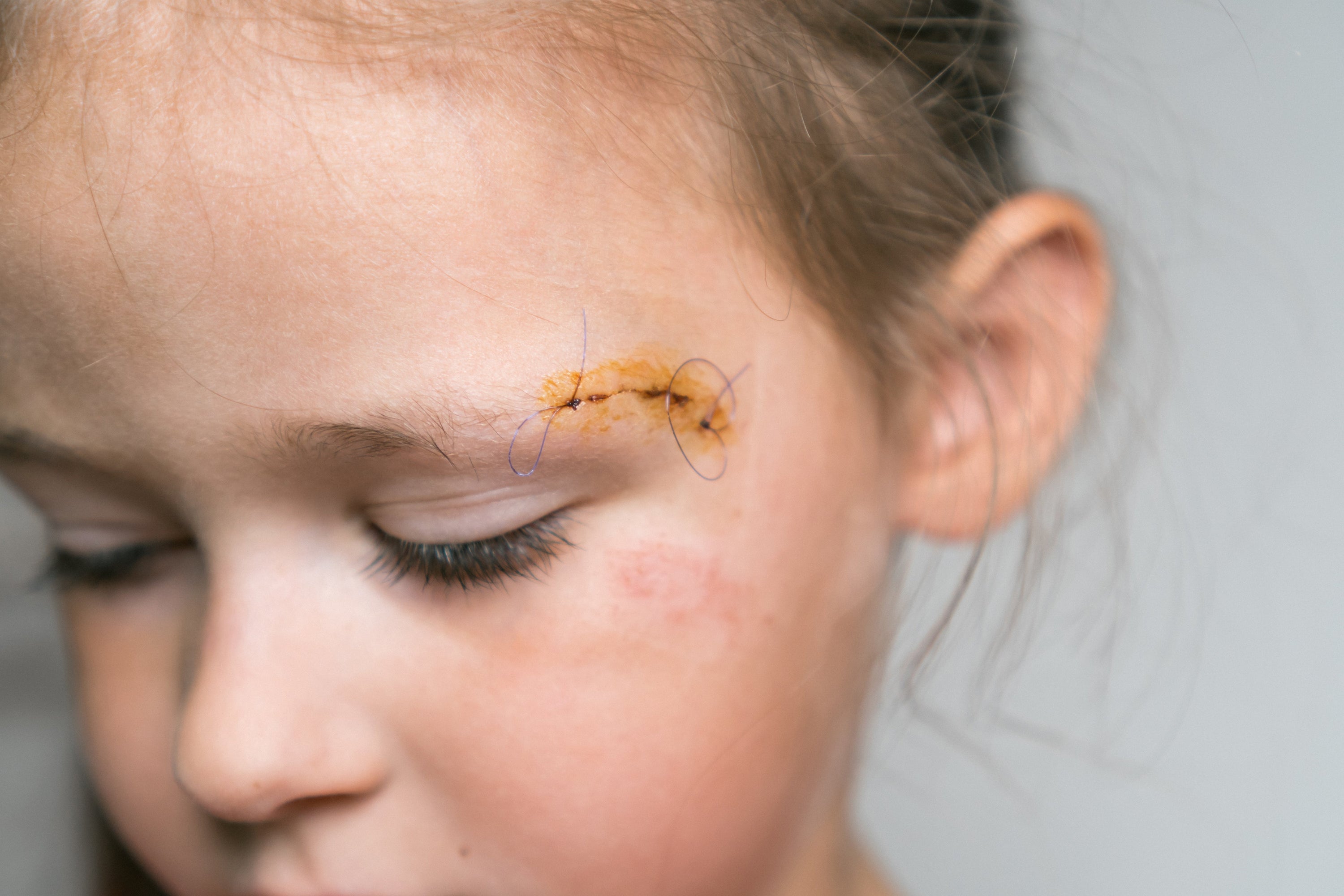 The Importance of Post-Procedure Repair