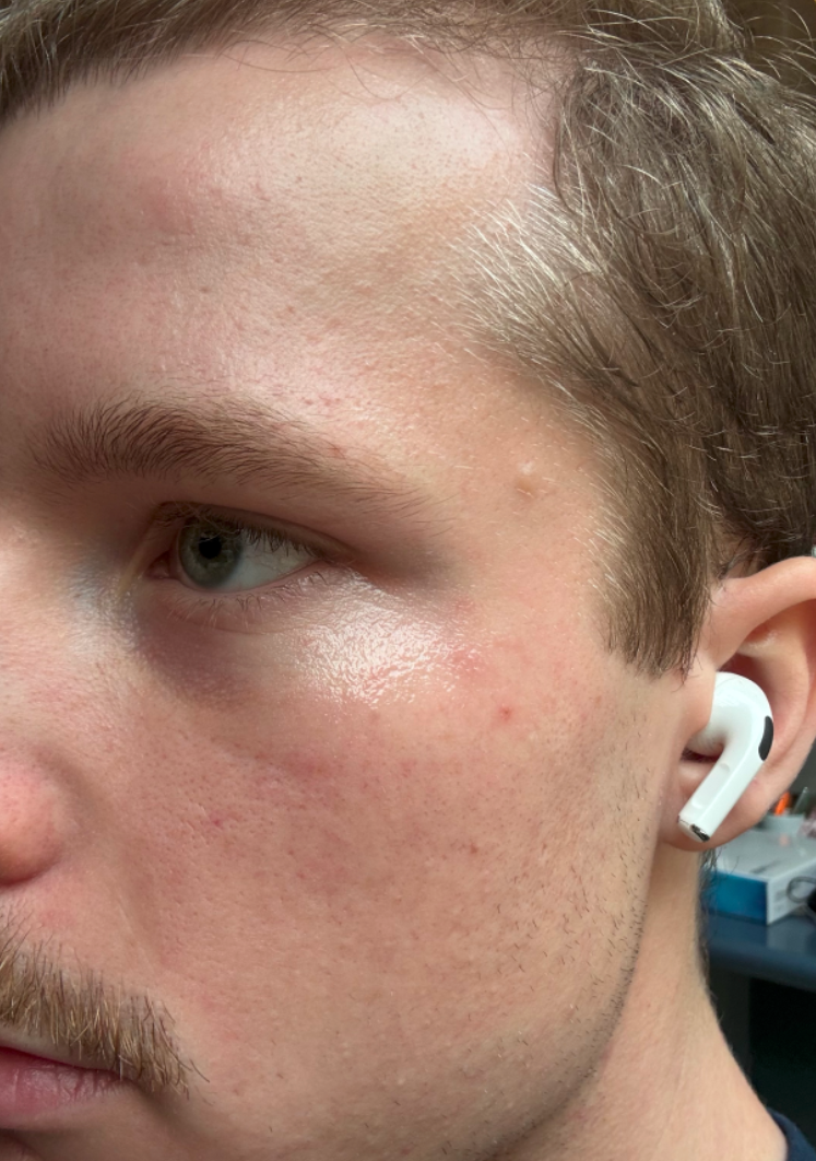 Close-up of a person with clear skin wearing a white wireless earbud.