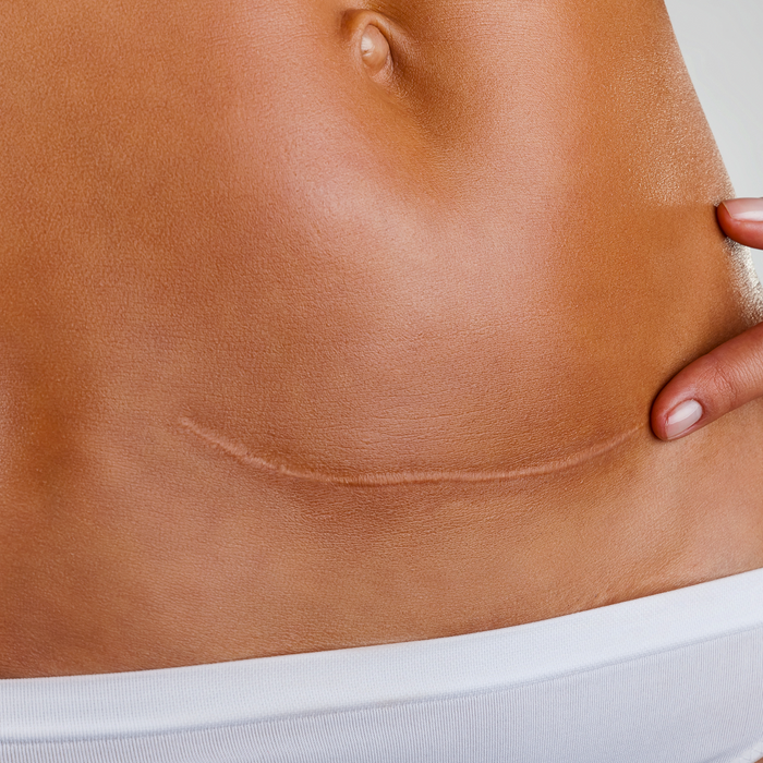 post-procedure & compromised