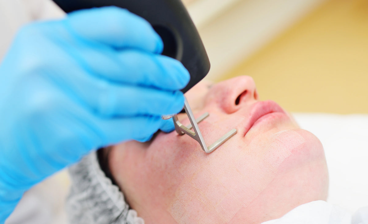 Ablative Laser