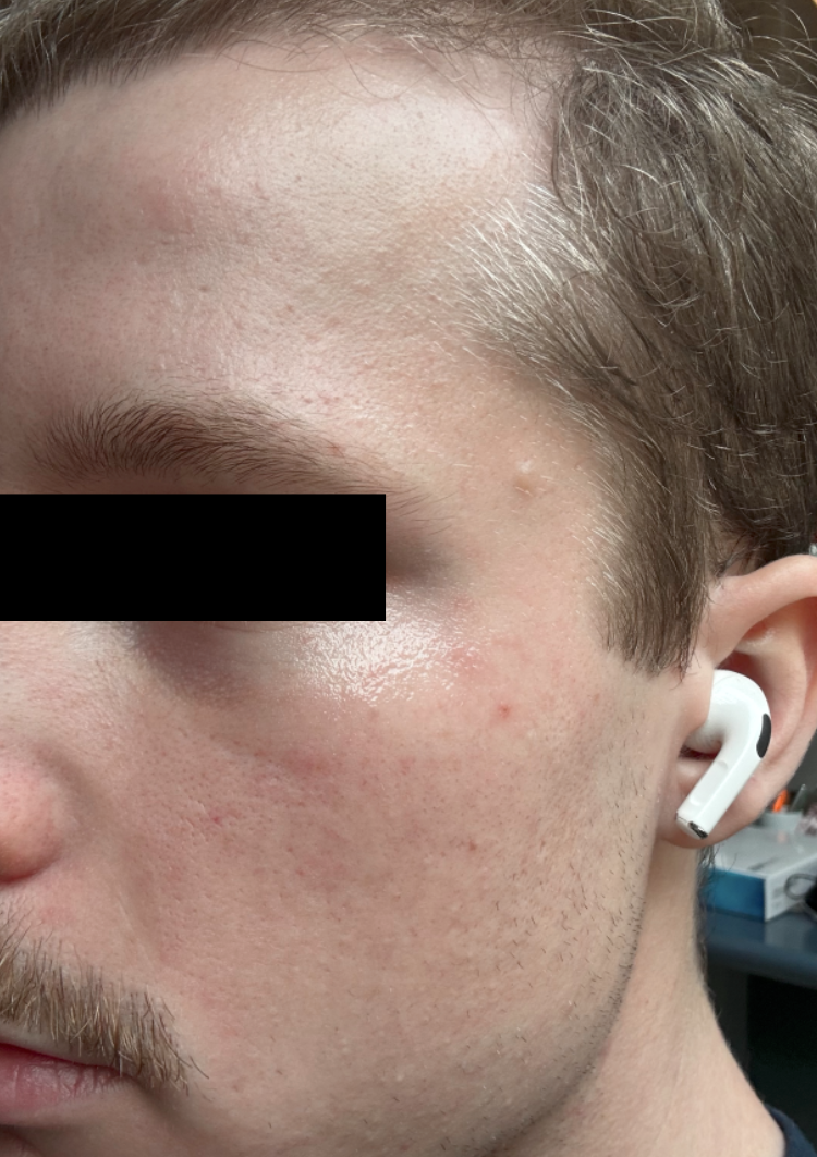 Close-up of a person's face with glowy, clearer skin 