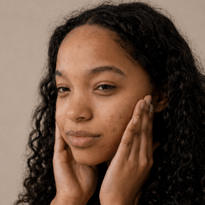 dark spots