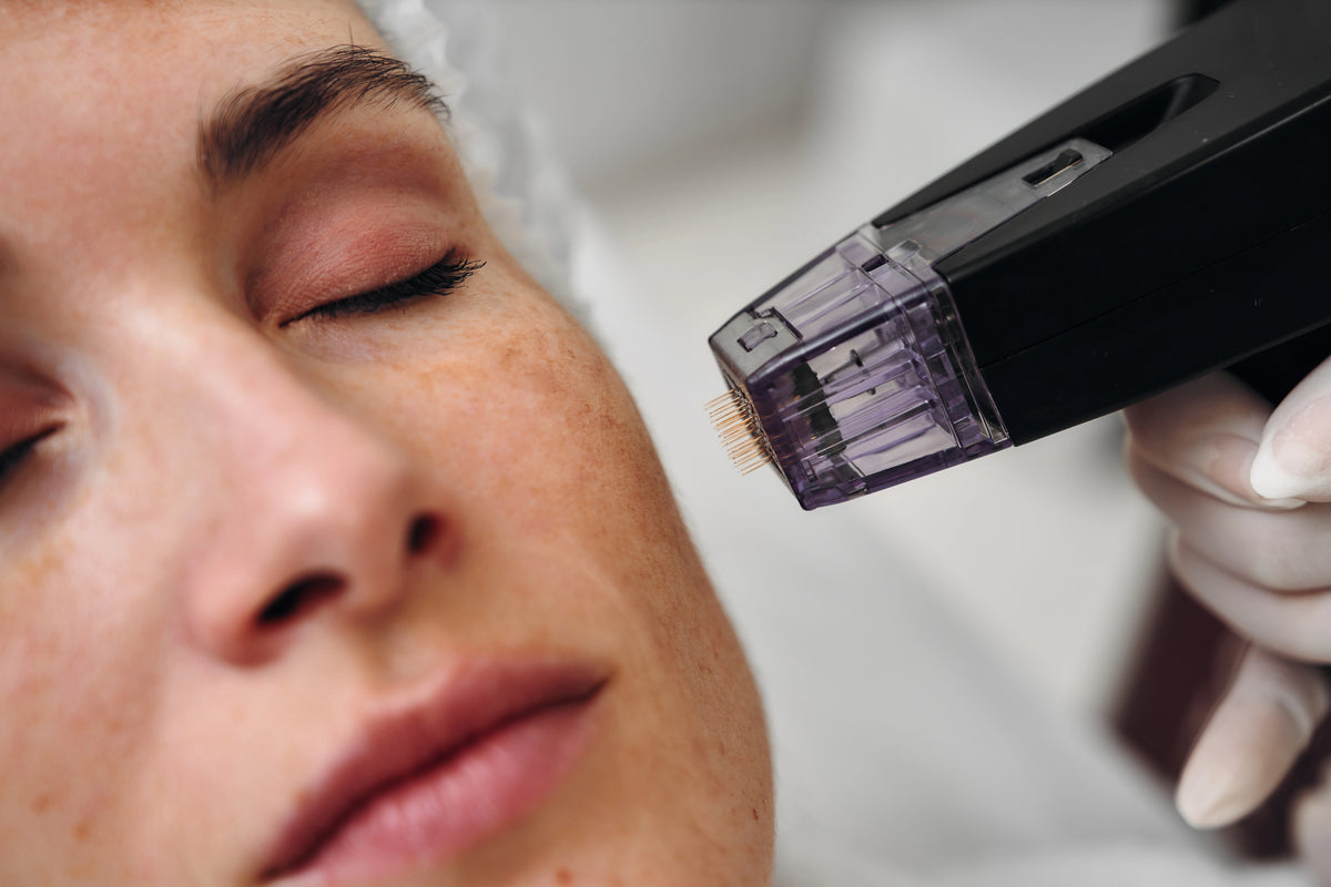 RF Microneedling