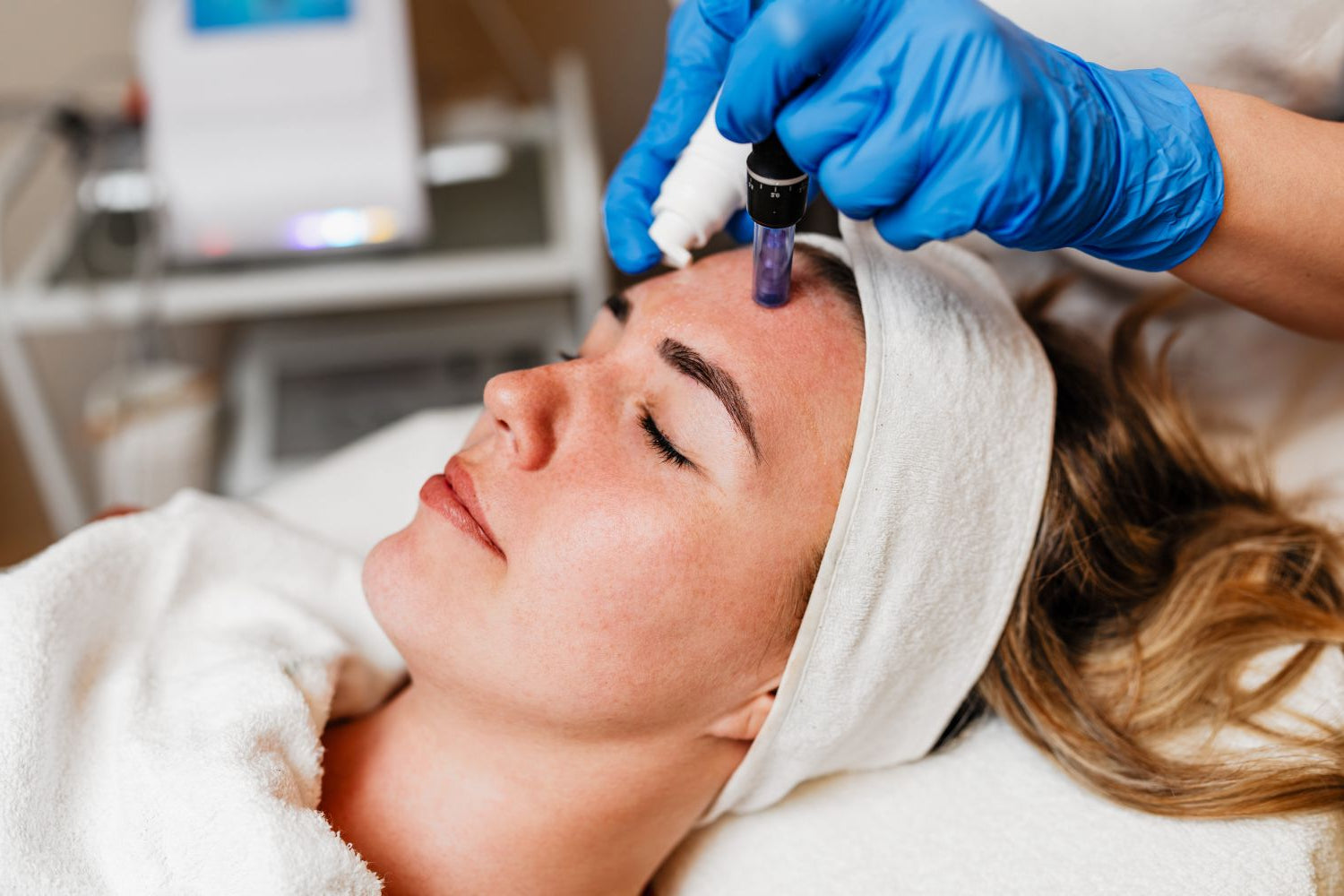 Microneedling