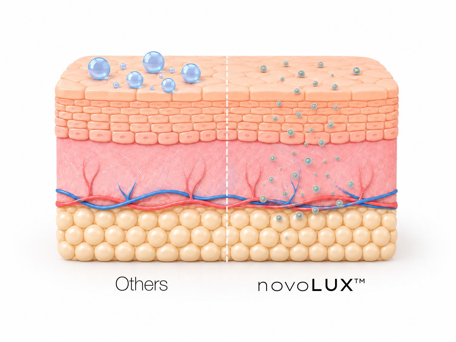 Model of human skin layers on a white background displaying the size and penetration of CNANO LNPs on the right compared to other brands