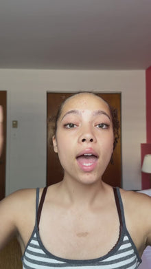 Acne Treatment Prep + Recovery Bundle