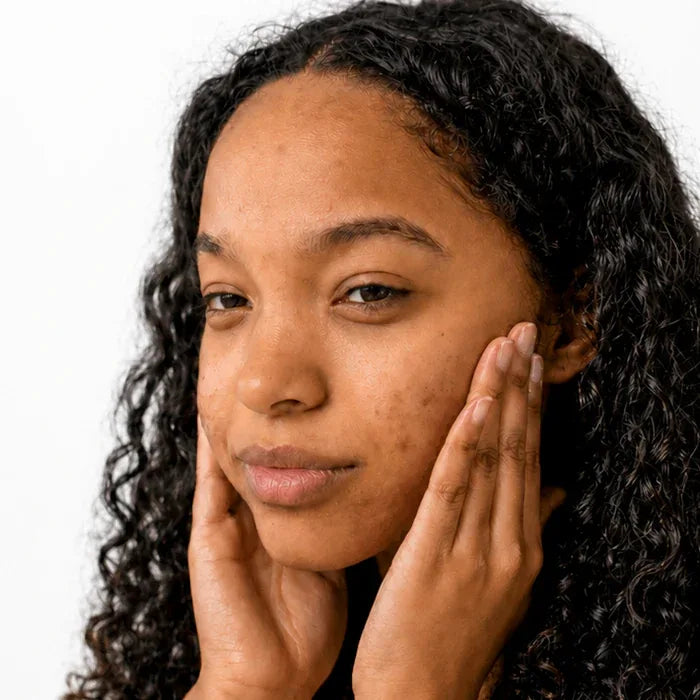 dark spots